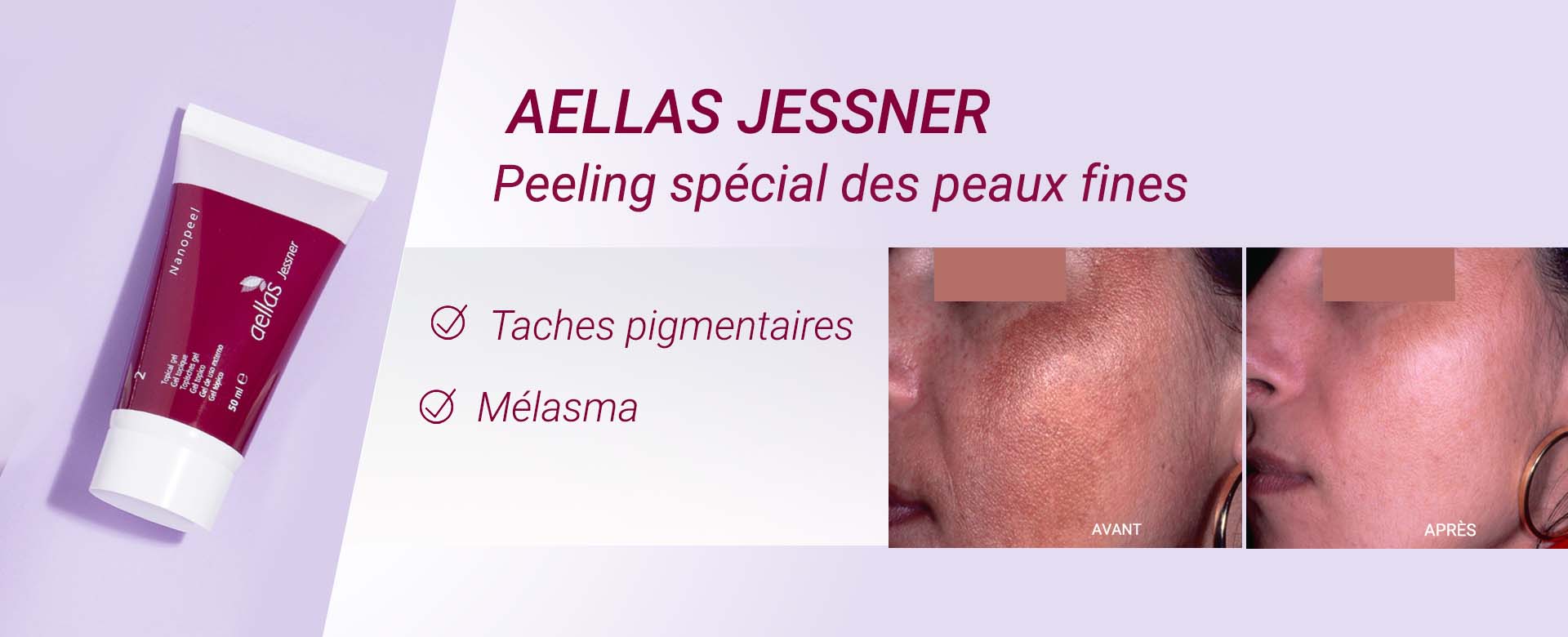 Aellas Jessner
