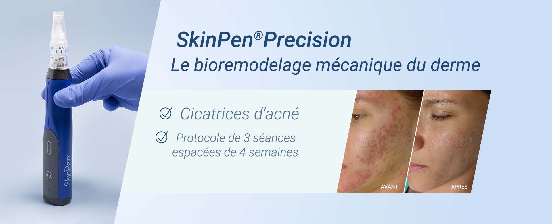 SkinPen_Precision_Novelskin